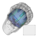 FE-Simulation von Kopfverletzungsrisiken mit Hilfe des Kopfmodells der Universität Straßburg (SUFEHM)